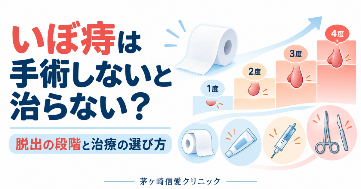 いぼ痔は手術しないと治らない？脱出の段階とALTA療法の選び方