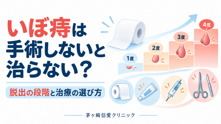 いぼ痔は手術しないと治らない？脱出の段階とALTA療法の選び方