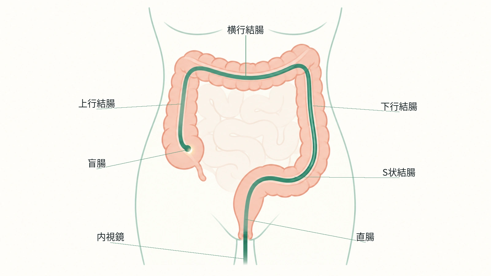 大腸の全体と、肛門から盲腸まで内視鏡で観察する範囲を示した図